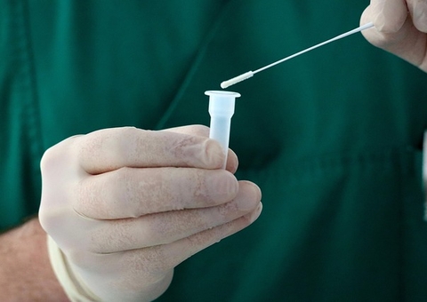 OMS faz recomendações temporárias para situações de surto por mpox