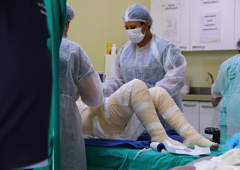 Mais de 130 pacientes foram atendidos no Centro de Tratamento de Queimados do 28 de Agosto