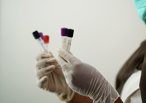 Amazonas recebe R$ 175,4 mil para compra de testes rápidos de gravidez