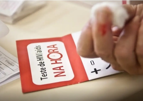 Aids: Brasil tem alta de casos, mas menor mortalidade desde 2013