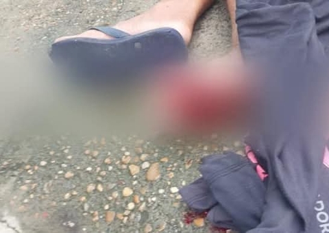 Homem perde parte do pé após pisar em catolé jogado por crianças em Manaus