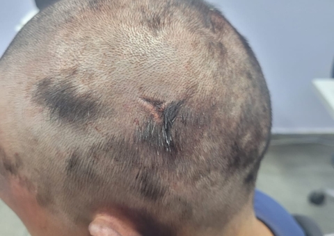 Homem é preso após torturar e raspar cabelo de ex-mulher em motel de Manaus