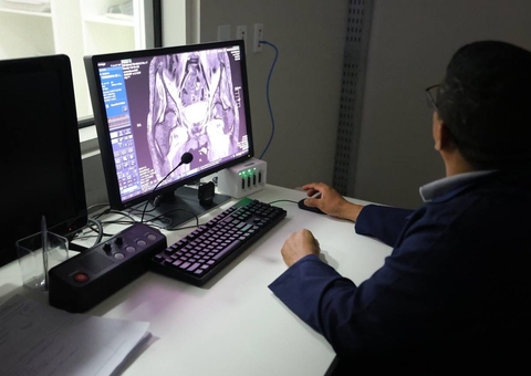 Serviço de ressonância passa a funcionar 24 horas no Hospital 28 de Agosto