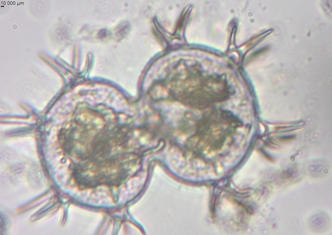 Pesquisa identifica duzentas espécies de microalgas em Parintins