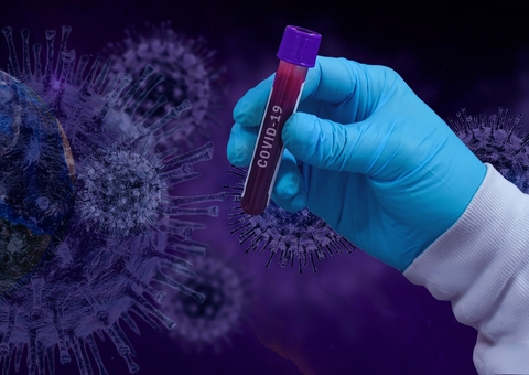 Transmissão da variante delta pode ser comunitária em São Paulo