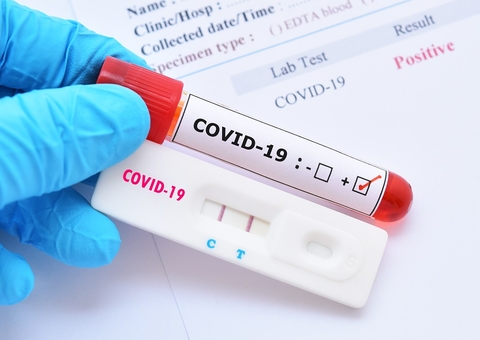 Japão confirma 2 atletas infectados com covid-19 em Vila Olímpica de Tóquio