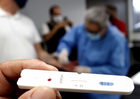 Amazonas registra 175 novos casos de Covid em 24 horas