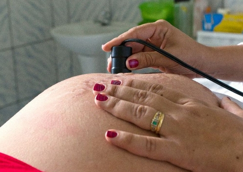 Exames de imagens feitos em maternidades no Amazonas devem ser fiscalizados