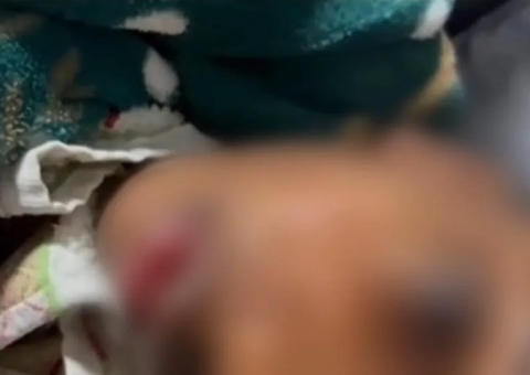 Criança negra de 5 anos é chamada de 'cocô' por colegas na escola