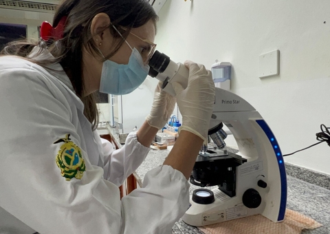 Amazonas registra mais de 200 casos de esporotricose; veja como se prevenir da doença