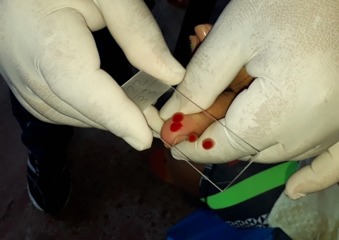 Em um ano, casos de malária reduzem 37% em Manaus