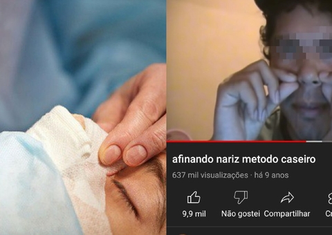 Rinoplastia caseira: Vídeos de como afinar nariz deixam homem internado e preocupam médicos