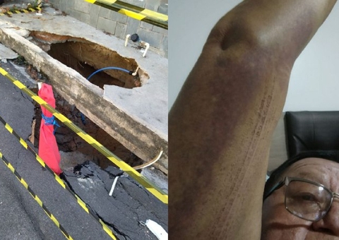 Obras na cratera que deixou idoso ferido em Manaus começam nesta sexta 