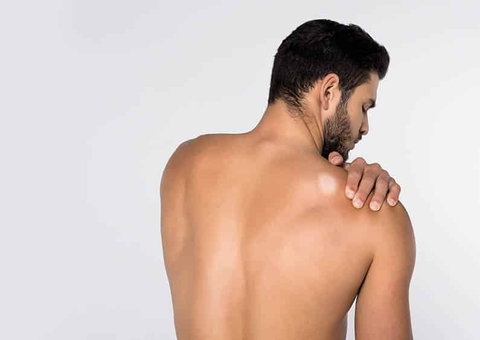 Fundação Alfredo da Matta inicia ações em Caapiranga para detectar casos de hanseníase