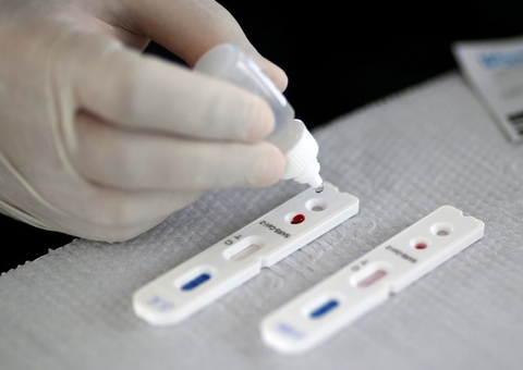  Brasil registra 55.271 novos diagnósticos de covid-19 em 24 horas