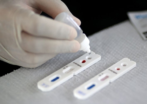 Confirmadas mais 1.541 mortes por covid-19 em 24 horas no Brasil