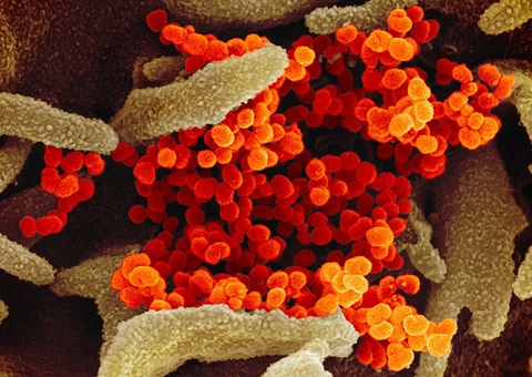 Variante encontrada em Manaus é três vezes mais contagiosa, diz Pazuello