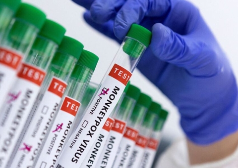 Varíola dos macacos: Anvisa orienta clínicas de reprodução assistida