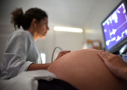 Auxílio Brasil: mulheres continuam com benefício durante a gravidez