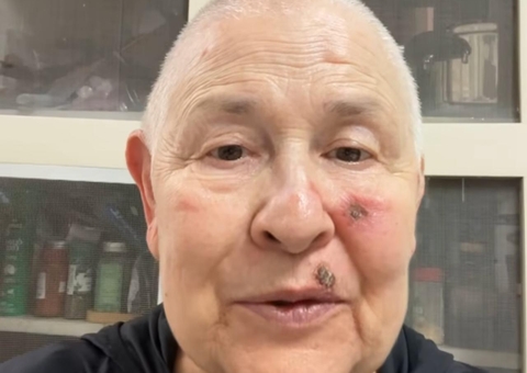 Monja Coen anuncia tratamento contra câncer