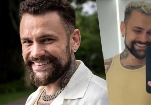 Ex-BBB Vinicius Rodrigues faz harmonização facial; confira resultado