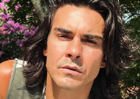 André Gonçalves mostra resultado após harmonização facial