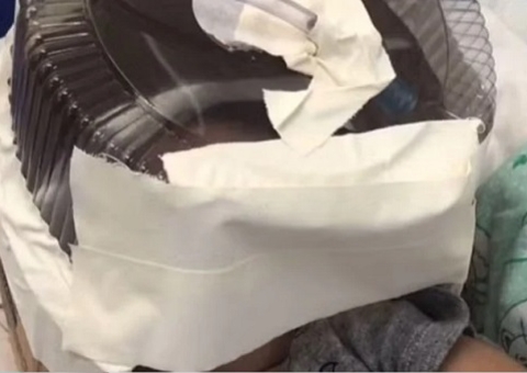 Bebê que usou embalagem de bolo como máscara de oxigênio deixa UTI
