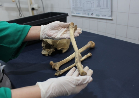 Antropologia forense é usada para identificar ossada de homem que estava desaparecido em Manaus