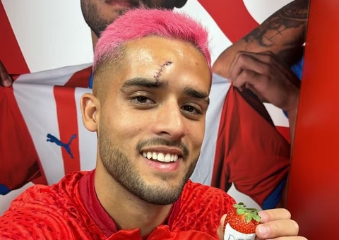 Yan Couto, do Girona, mostra pontos no rosto após choque com companheiro