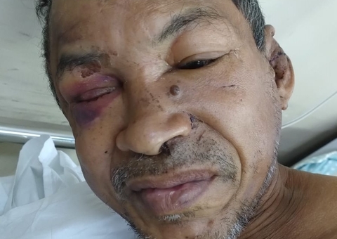 Hospital João Lúcio procura família de paciente internado por espancamento