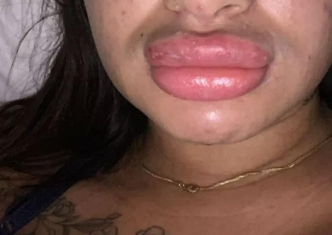 Falsa biomédica é investigada por deformar mais de 30 mulheres em SC