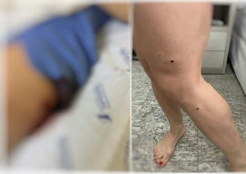 Polícia pede prisão do dono da Funerária Canaã que atirou em sócia em Manaus