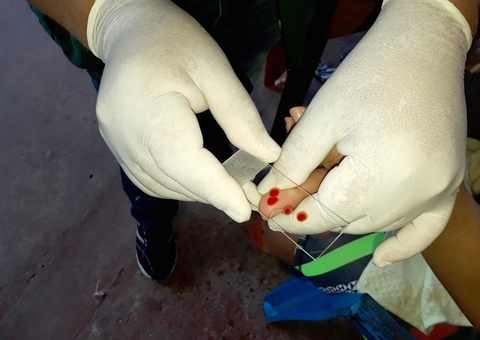 Manaus tem redução de 15,40% de casos de malária