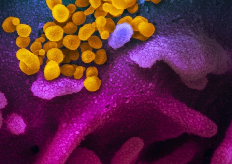 Brasil registra 657.205 mil mortes por covid-19