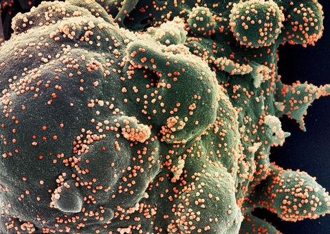 Brasil registra 394 mortes por covid-19 nas últimas 24 horas