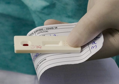 Brasil registra 57.472 novos casos de Covid e 1.212 mortes pelo vírus