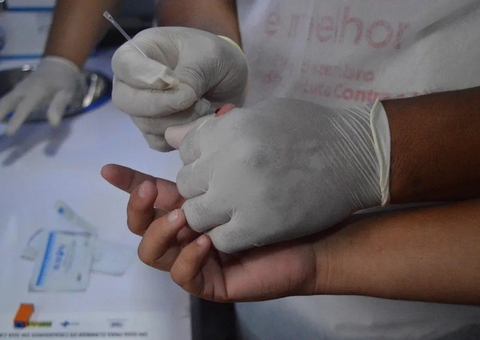 Lei estimula realização de teste rápido de HIV/AIDS no Amazonas