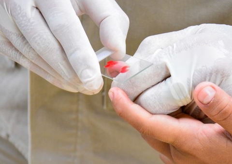 Nova medicação no tratamento de malária será implementada em Manaus