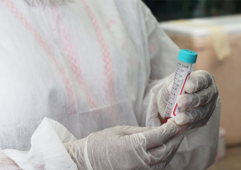 Amazonas não registra mortes por Covid-19 pela terceira vez neste mês