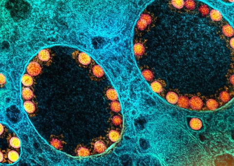 Covid-19: Brasil tem 62 mortes confirmadas nas últimas 24 horas