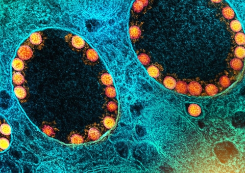 Fiocruz confirma subvariante Ômicron BQ.1 na cidade do Rio de Janeiro