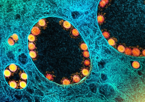 Covid-19: em 24 horas foram registrados 44.830 novos casos