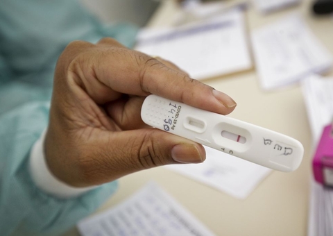 Anvisa aprova uso e venda de autoteste para covid-19