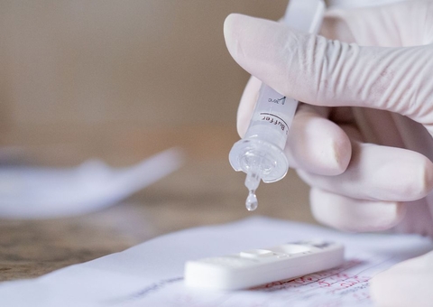 Amazonas registra nas últimas 24 horas 653 novos casos de Covid