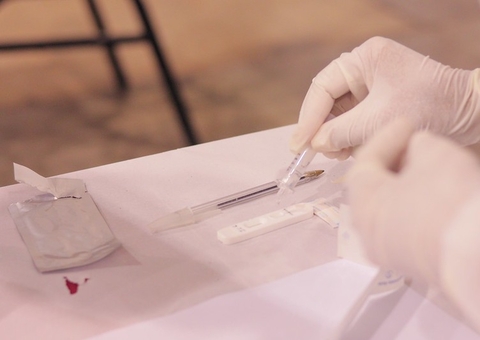 Mais de 20% dos exames realizados no Centro de Testagem em Manaus foram positivos para Covid-19