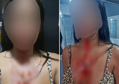 Mulher é brutalmente agredida em academia ao conversar com amigo sobre política