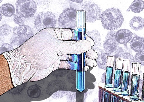 Vacina contra HIV, da Johnson & Johnson, se mostra ineficiente contra o vírus