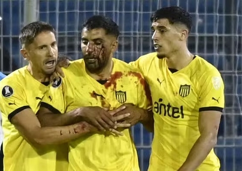 Libertadores: Conmebol abrirá processos sobre pedrada e racismo