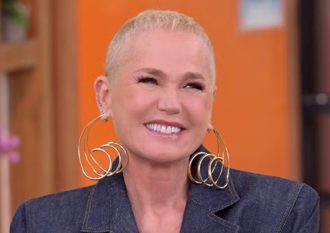 Xuxa revela que tem calvície e passou por transplante capilar