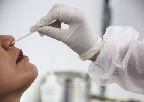 FVS investiga 8 casos suspeitos de covid-19 no Amazonas